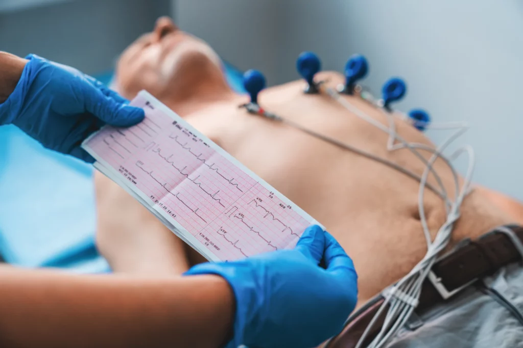 EKG utskrivet på traditionellt vis